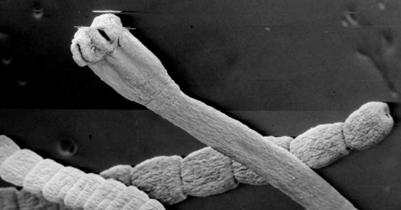 worms of the human body